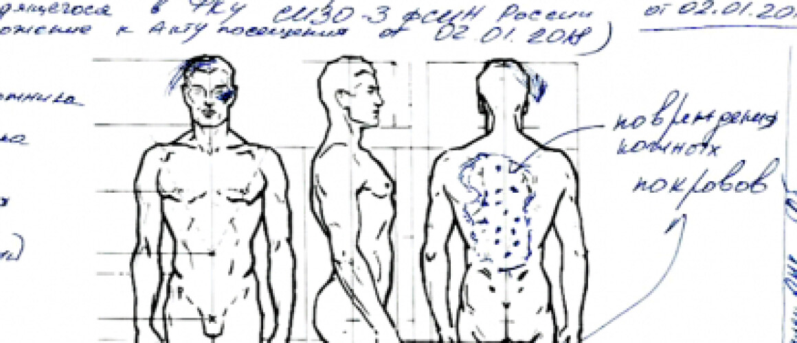 Акт визуального осмотра Игоря Шишкина членами ОНК, обнаружевшего следы пыток